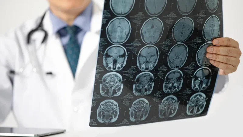 clínica de neurologista